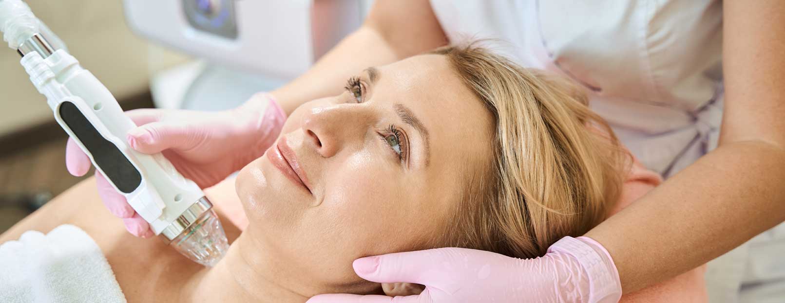 Tratamiento facial dermapunt en Alcalá de Henares
